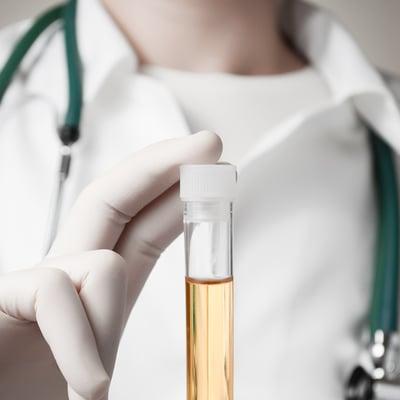 PLS - Pathology Laboratory Services - Urine Toxicology