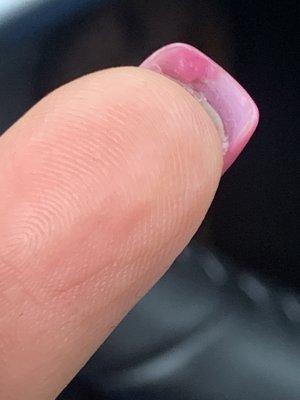 Acrylic buildup where nail won't grow correctly