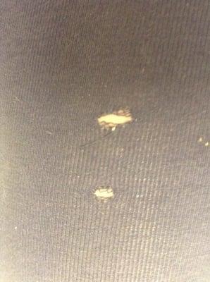 This is the holes in the leggings