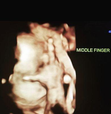 Sneak A  Peek 4D ultrasounds