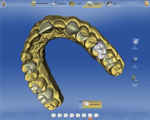 Same-visit crowns using CAD/CAM technology