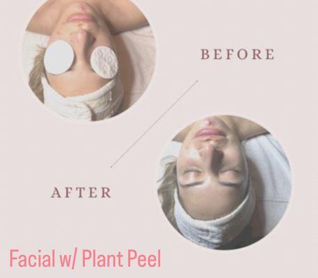 Facial with plant peel