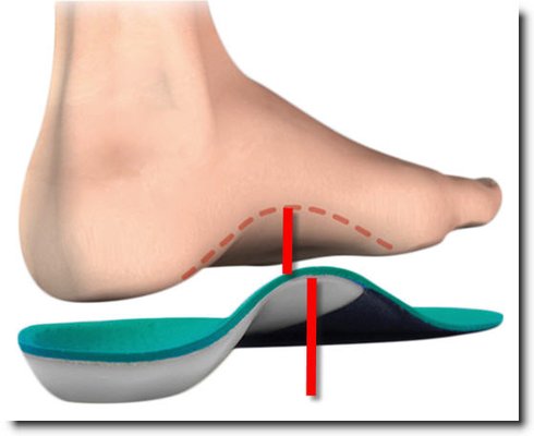 Foot Orthotics for correction of foot problems, such as plantar fasciitis, fallen arches and other aliments.