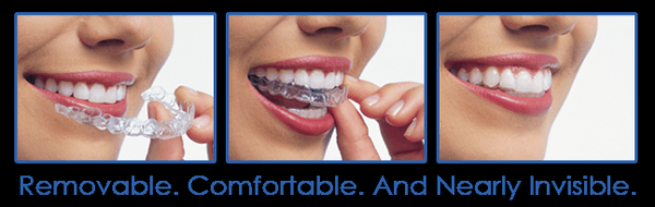 Dr. Trufas is a proud Invisalign provider.  Do you love your smile?  Ask if you are a candidate to schedule your Free Invisalign Consult!