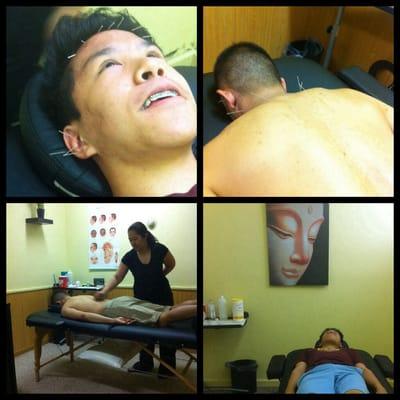 My brother & son getting acupuncture...