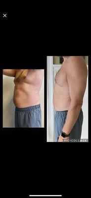 Cool Sculpting Elite, Trusculpting available. Non invasive fat elimination treatments.