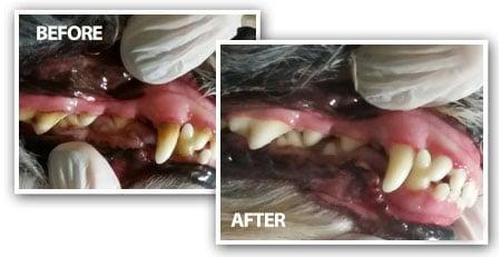 Before & After Teeth Cleaning