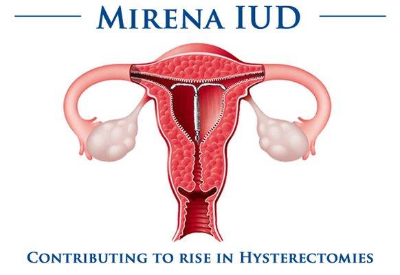 Dr Saygo is the best at IUD's insertions- See my review for my experience!