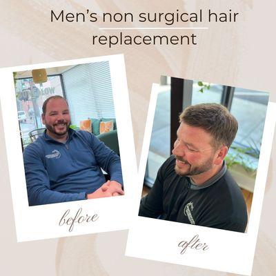 The new go-to local spot for Men's non surgical hair replacement.