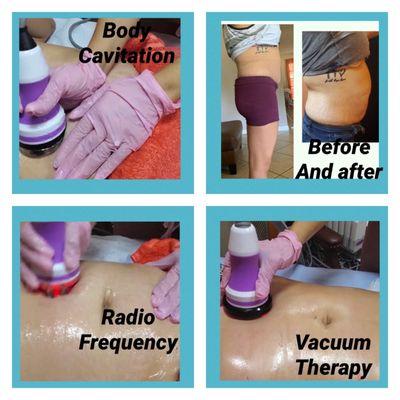 Body cavitation before and after.