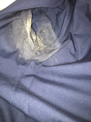 Deodorant stain that was removed with a rag and warm water seems they sprayed something on it that turned it a weird color.