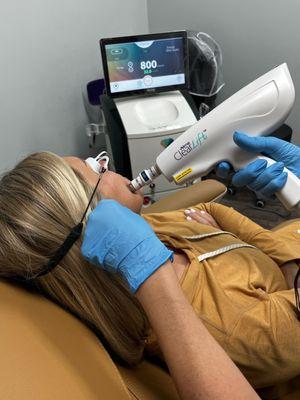 ClearLift Laser Lift Facial. ClearLift by Alma Lasers.