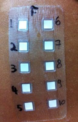 Contact allergy testing: may be due to chemical products, dyes, perfume etc...