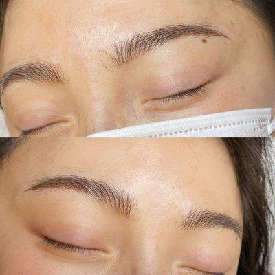 Microblading