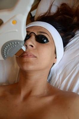 Laser hair removal