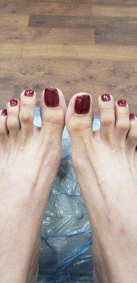 Bad pedicure