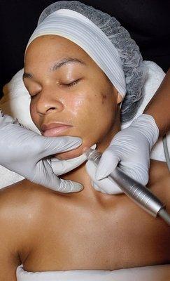 Dermeluxx facial.