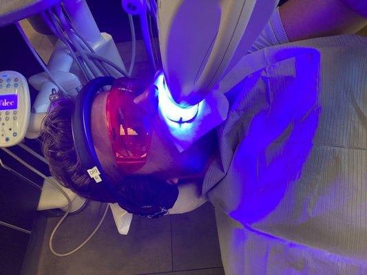 Zoom teeth whitening