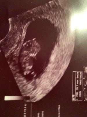 Our little peanut