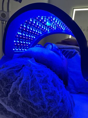 FDA approved acne Led light therapy