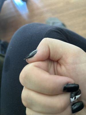 Jagged nails