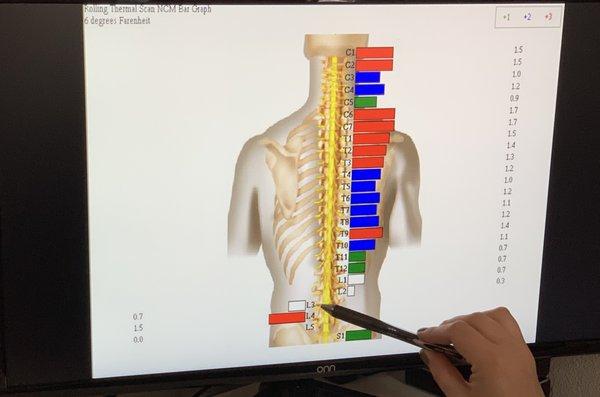 CLA INSiGHT technologies allows us to see how your nervous system is functioning and, in turn, the rest of your body.