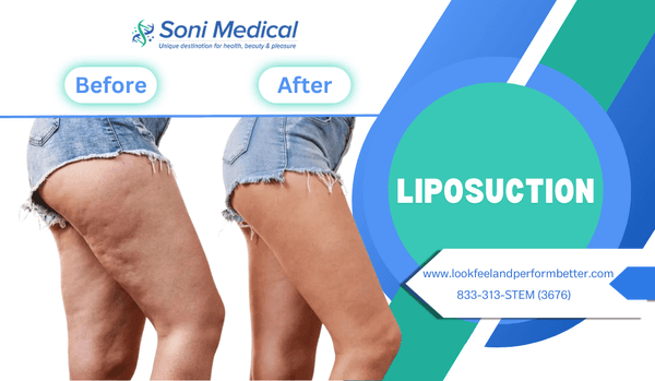 Liposuction and other weight loss solutions at Soni Medical Center in Brooklyn.