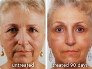 Galvanic technology with ageLOC technology, proven to tun off aging genes and prevent accelerated age bursts.