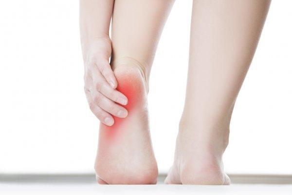 Be rid of your heel pain/plantar fasciitis once and for all