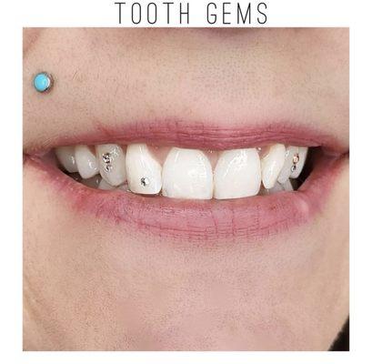 Tooth Gems Can Be Applied On Any Natural Tooth - Add Some Sparkle To Your Smile!