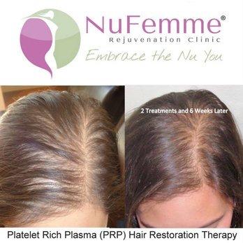 NuFemme Rejuvenation Clinic - Las Vegas