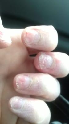 destroyed my nails