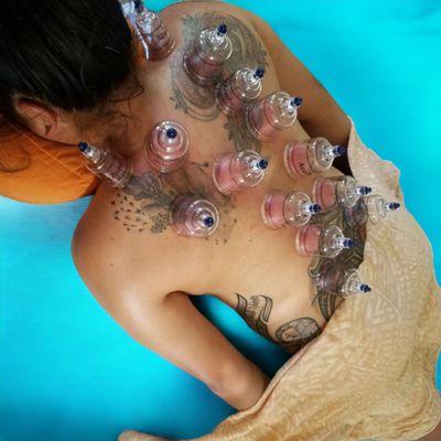 Cupping therapy helps improve blood circulation,  boost immunity and helps loosen connective tissues.