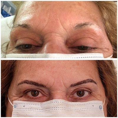 Microblading