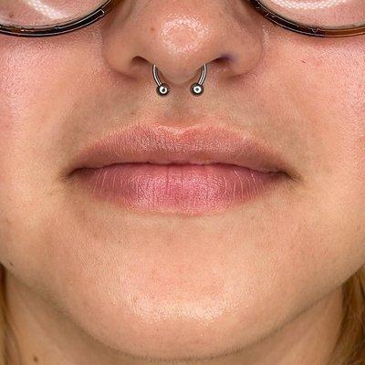 Septum