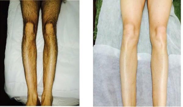 Full leg wax before & after