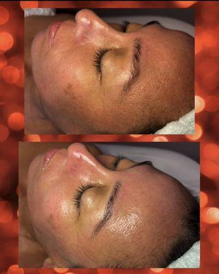 Hydrating & Brightening Facial