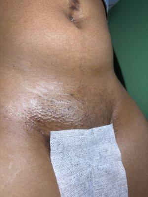 Brazilian Wax