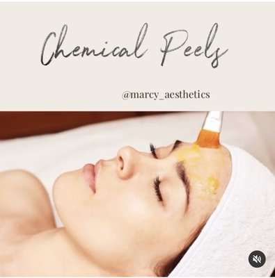 Chemical Peels