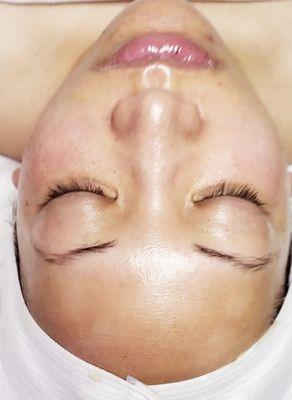 Thw Glow you get after a healthy skin facial.