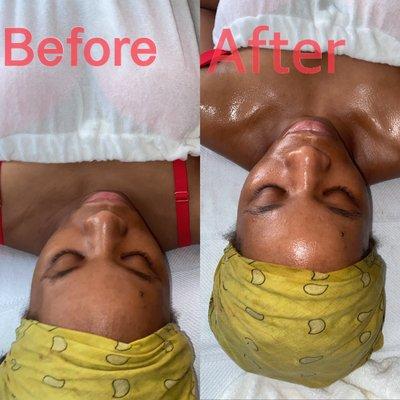 Detox deep cleanse facial