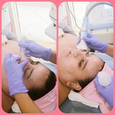 O2 Water Dermabrasion Oxygen & mineral O2 solutions.  Sebum & pore jet detox. Solution to problematic acne, dirt pores & sebum.