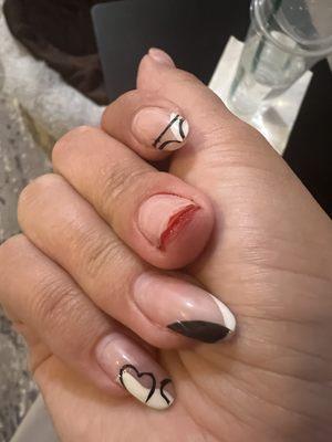 Came off without even hitting my nail on anything and ripped my skin!