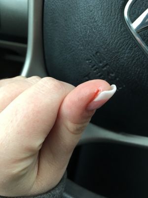 Cut on thumb from nail tech being aggressive when filing. I hope I don't get an infection.