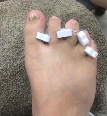 My toe the week after getting my nails done at Oasis