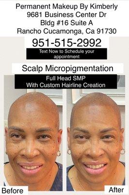 Having thick, healthy hair is a sign of youthfulness and can bring a sense of confidence to clients. Get your scalp micropigmentation today!