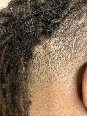 Bald spot from loc being clipped