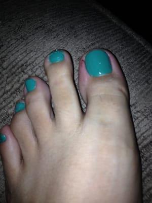 My toe a day after a painful pedicure... Seriously worried it might get infected.