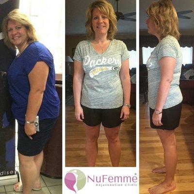 Medical Weight Loss for women - NuFemme in Milwaukee Wisconsin