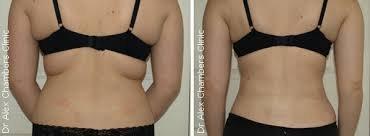 Body Appearances - Your Premier Body Sculpting & Anti-aging Center.